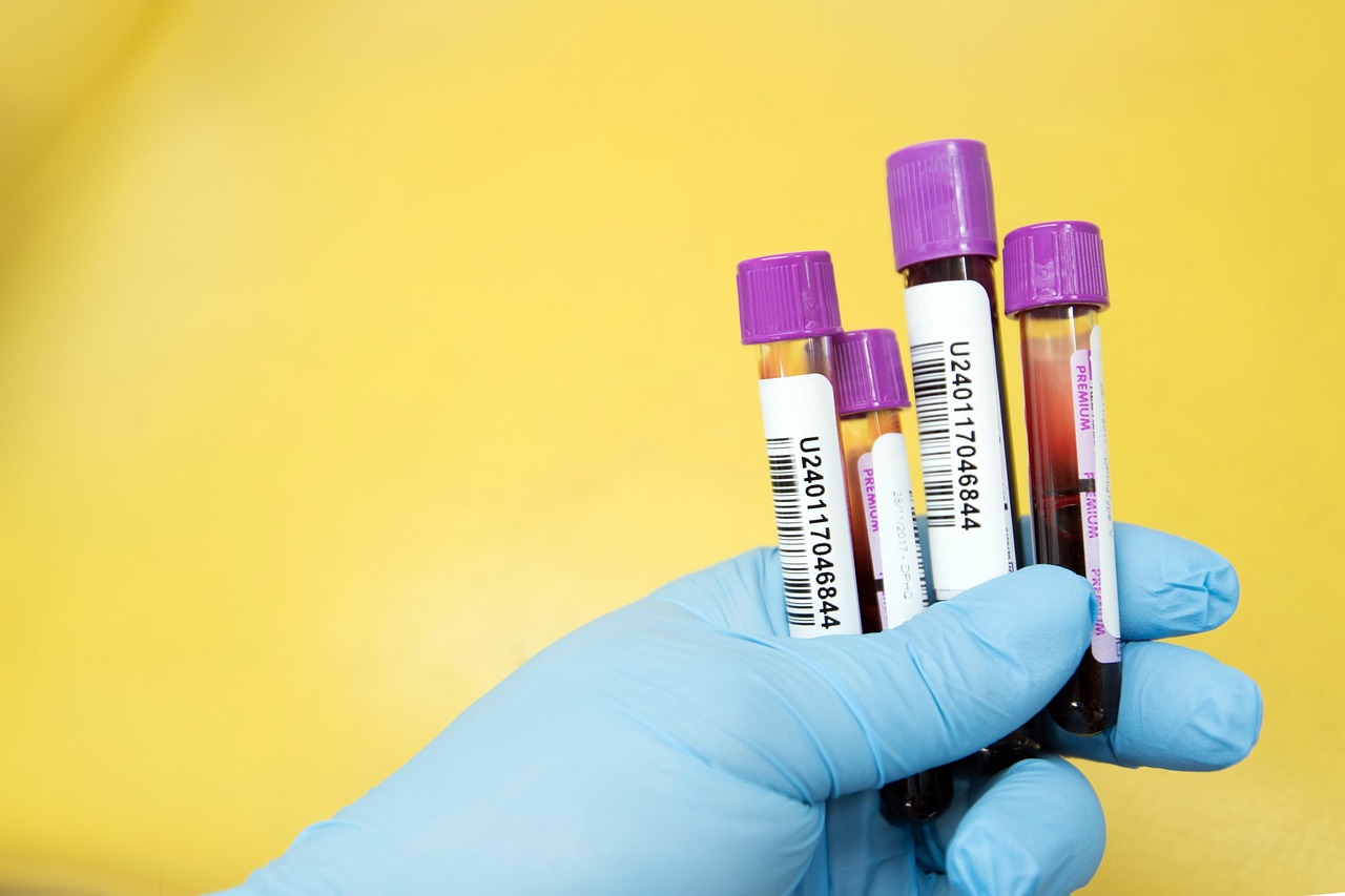 sample, lab, laboratory, scientist, test, medical, healthcare, health, research, science, tube, yellow health, yellow medical, yellow science, yellow research, yellow lab, yellow test, yellow blood, yellow laboratory, yellow healthcare